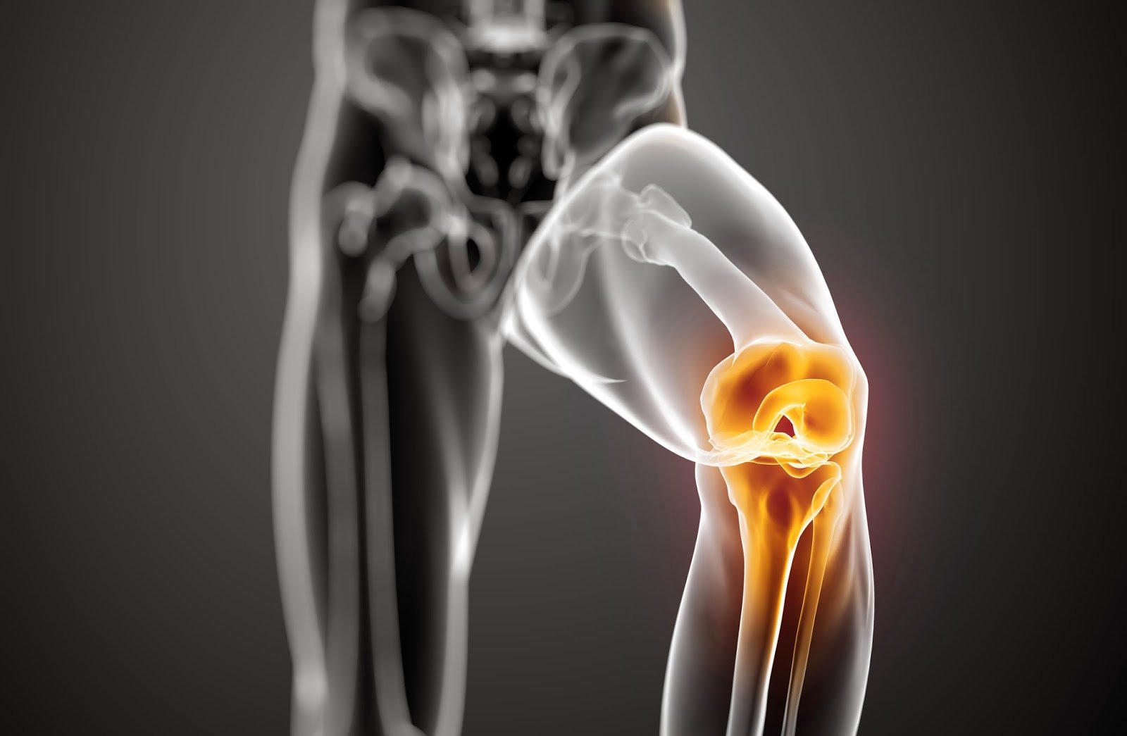 LCA se refiere al ligamento cruzado anterior. Es 1 de los 4 ligamentos de la rodilla.